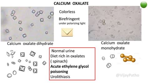 URINARY CRYSTALS - Pathology Made Simple