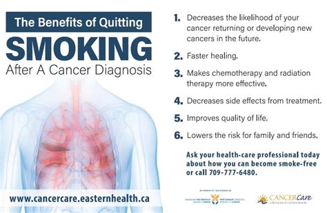 Smoking Cessation Program – Cancer Care