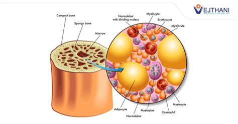 How Bone Marrow Transplant (Stem Cell) is used to Treat Cancer ...