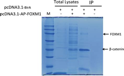 Coomassie blue staining of FOXM1 and its interacting proteins. The... | Download Scientific Diagram