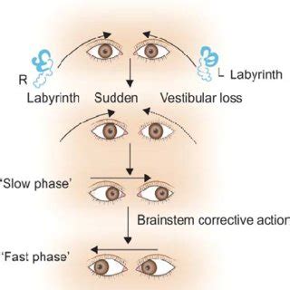 Difference Between Horizontal Nystagmus And Vertical, 59% OFF