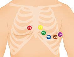 643 Best 12 Lead EKG images in 2019 | Cardiac nursing, Nursing, Nursing notes