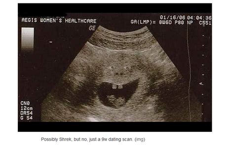 Check Out These Hilariously Funny Ultrasound Pictures of Unborn Babies - LifeNews.com ...