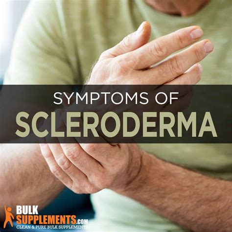 Scleroderma: Symptoms, Causes & Treatment