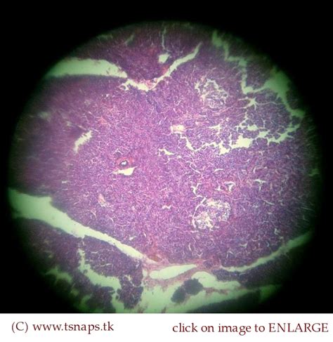 Histology Slides Database: pancreas histology slides