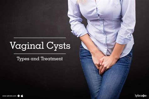 Vaginal Cysts - Types and Treatment - By Dr. Hemali A Desai | Lybrate