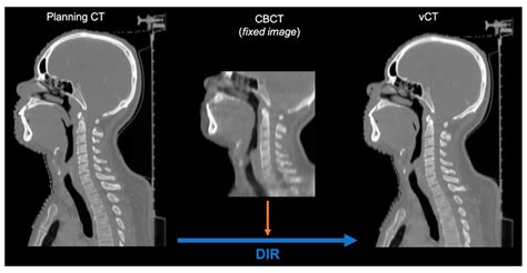 Cone Beam Ct Vs Conventional - The Best Picture Of Beam