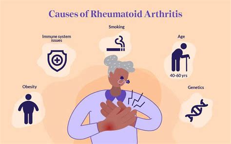 Causes of rheumatoid arthritis - MEDizzy