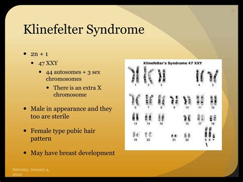 PPT - Non-Disjunction, Aneuploidy & Abnormalities in Chromosome ...