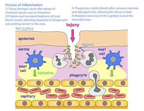 Proteolytic Enzymes and Inflammation — Grassroots Physical Therapy