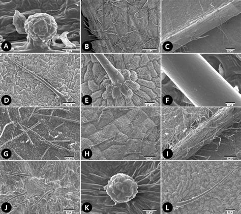 Scanning electron microscope micrographs of trichomes of tribe... | Download Scientific Diagram