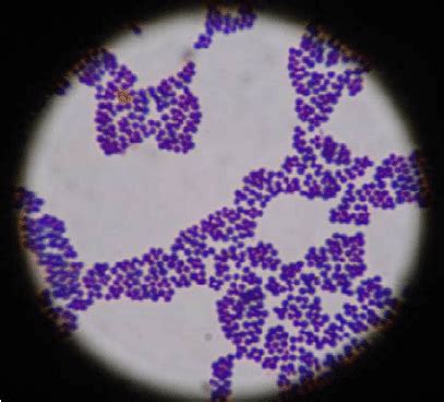 Staph Epidermidis Gram Stain | Hot Sex Picture