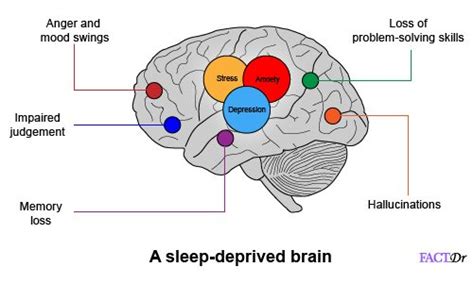 10 reasons why sleep deprivation is harmful for you | FactDr