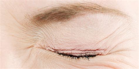 Have Eye Pain? Here's When to See a Doctor ASAP | SELF