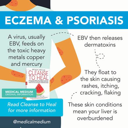 Eczema & Psoriasis