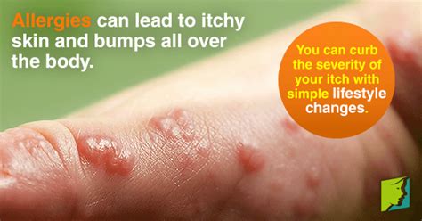 Itchy Bumps on the Skin: Causes | Menopause Now