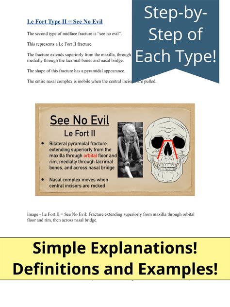 Le Fort Fracture Types PDF: Classification, Definition, Treatment of Type I, Type II, Type III ...