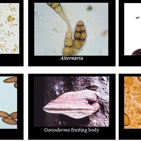 Pictures showing different types of fungal spores | Download Scientific ...