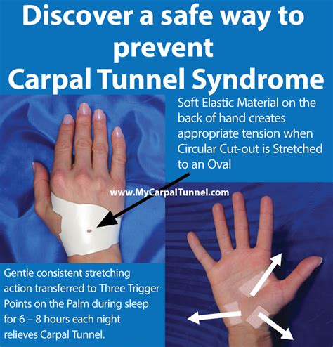 Preventing Carpal Tunnel Syndrome | My Carpal Tunnel