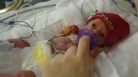 Grace 11 days old 30 week preemie | Preemie, Premature baby, 30 weeks