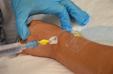 8.5 Flushing a Saline Lock and Converting a Saline Lock to a Continuous IV Infusion – Clinical ...