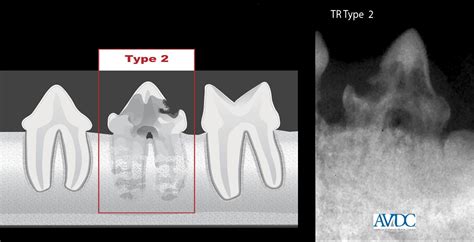 30 Best Images Resorptive Lesions In Cats / Feline Tooth Resorption ...