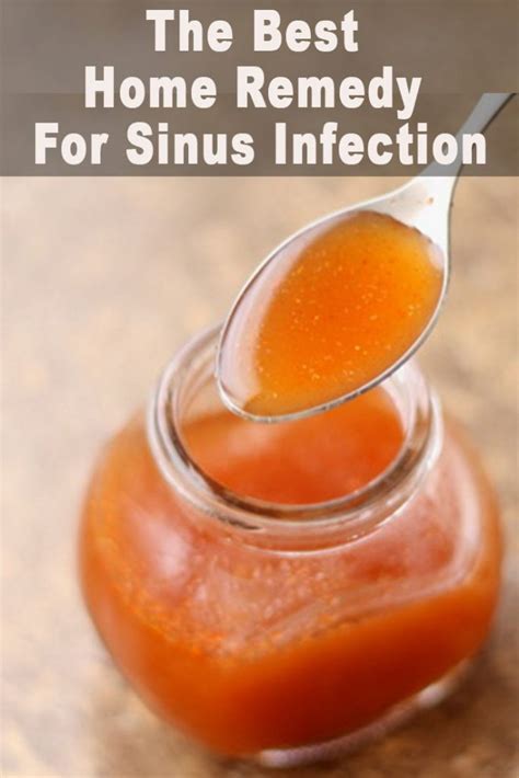 The Best Home Remedy For Sinus Infection Sinus inflammation accompanied by stuffy nose, wheezing ...