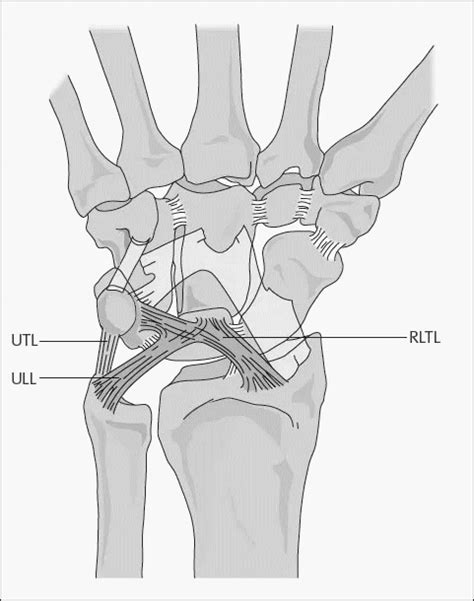 Wrist Ligaments | Epomedicine