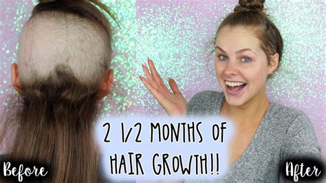 1/2 inch hair growth 107311-1/2 inch hair growth