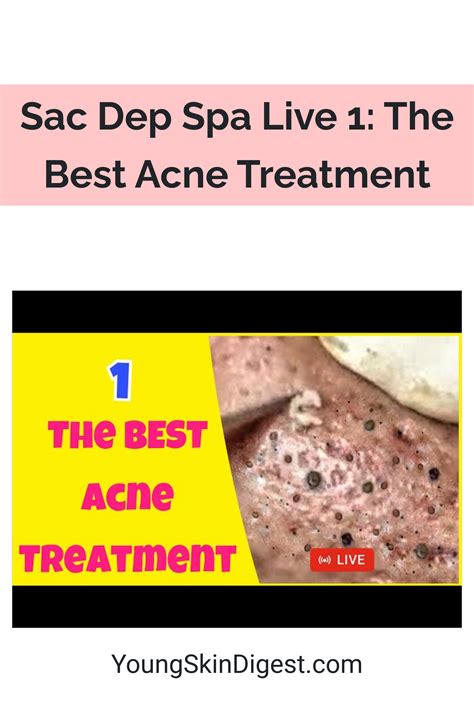 Sac Dep Spa Live 1: The Best Acne Treatment - Young Skin Digest