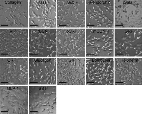 Cell adhesion on amyloid fibrils. Representative phase-contrast images... | Download Scientific ...