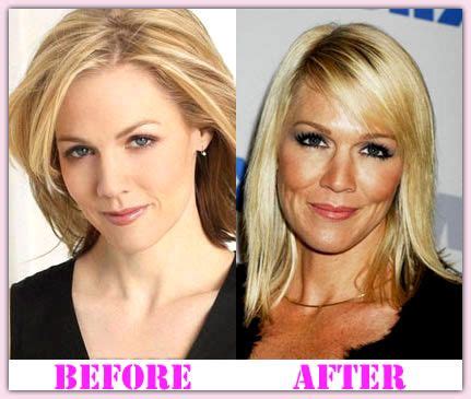 Jennie Garth Plastic Surgery – Turn Back Time | Plastic surgery ...