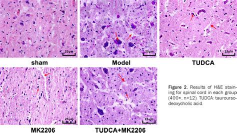 Figure 2 from Mechanism of tauroursodeoxycholic acid-mediated neuronal ...