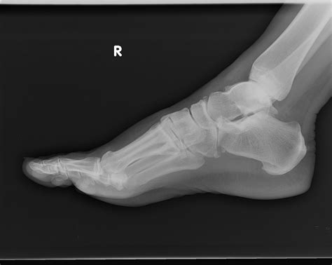 Radiology Cases: January 2011