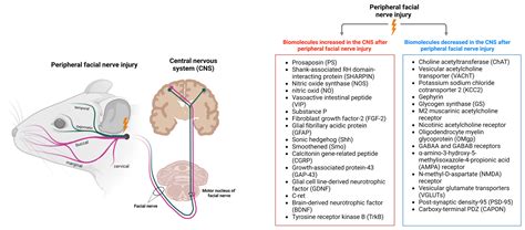 Facial Nerve Palsy Diagram