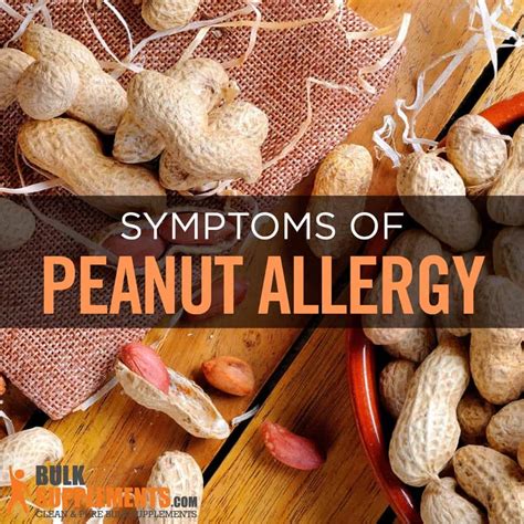 Can Peanut Allergy Go Away Archives