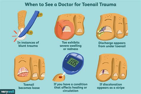 Black Dot In My Little Toenail - Nail Ftempo