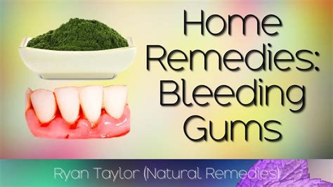 Home Remedies: for Bleeding Gums - YouTube