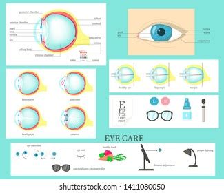 Human Eye Structure Diagrams Diseases Disorders Stock Vector (Royalty ...