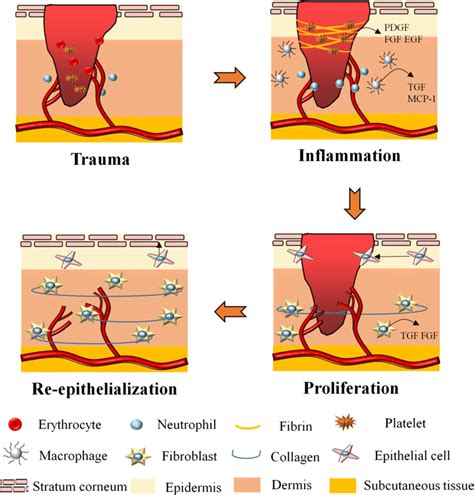 Physiology Of Wound Healing