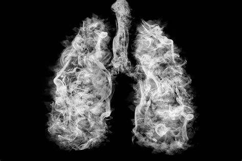 Lung Infection in COPD: Signs, Symptoms, Complications