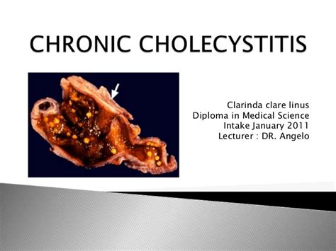 Chronic cholecystitis