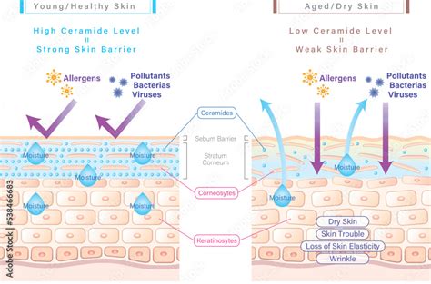 Vetor de Ceramide in skin and skin barrier illustration comparing ...