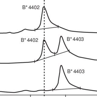 HLA-B locus matching. Electropherogram demonstrating matching at HLA-B... | Download Scientific ...