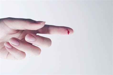 Common Causes of Finger Injuries