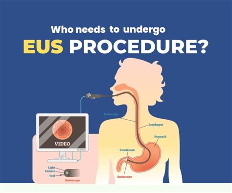 Endoscopic Ultrasound - Harini Hospitals