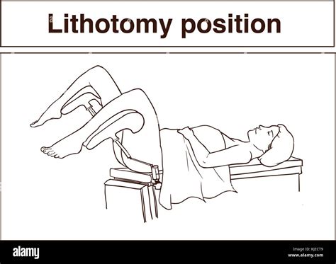 Dorsal Lithotomy Position