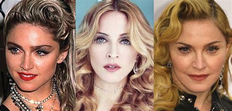 Madonna Plastic Surgery Before and After Pictures 2018