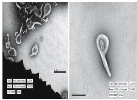 Micrographs of Mycoplasma pneumonia transmission electron developed in... | Download Scientific ...