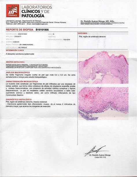 Biopsy Report: Common Old Man Skin Cancer - Retired in Costa Rica